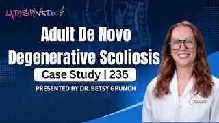 Case Study 235 | Rebound headaches (medication overuse headaches) | Explained by Dr. Betsy Grunch