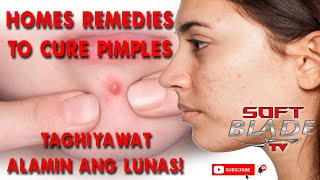 PIMPLES HOME REMEDIES | LUNAS NG TAGHIYAWAT ALAMIN! screenshot 1