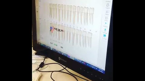 VoiceWorks in Action!