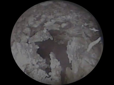 Vol.241【耳掃除】左耳のみ～1年ぶりに予約取れました！！～eariss