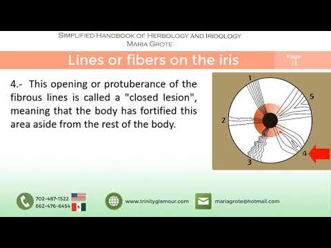 Lines or fibers on the iris   |   Simplified iridology by Maria Grote