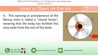 Detailed Lines or fibers on the iris | Simplified iridology by Maria Grote Profile