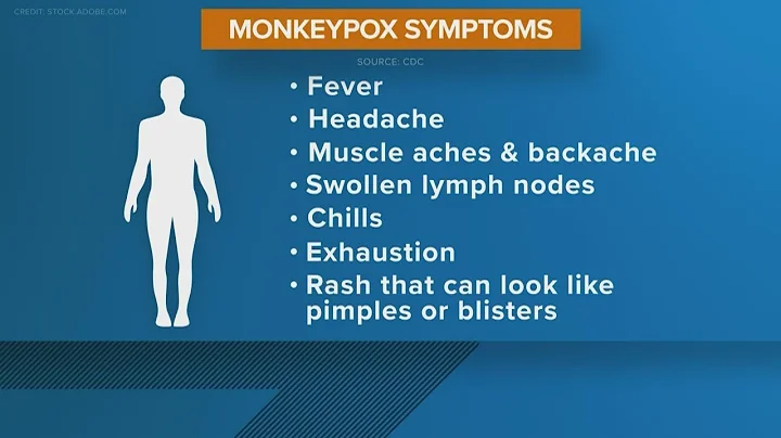 Two cases of monkeypox confirmed, San Antonio Metr...