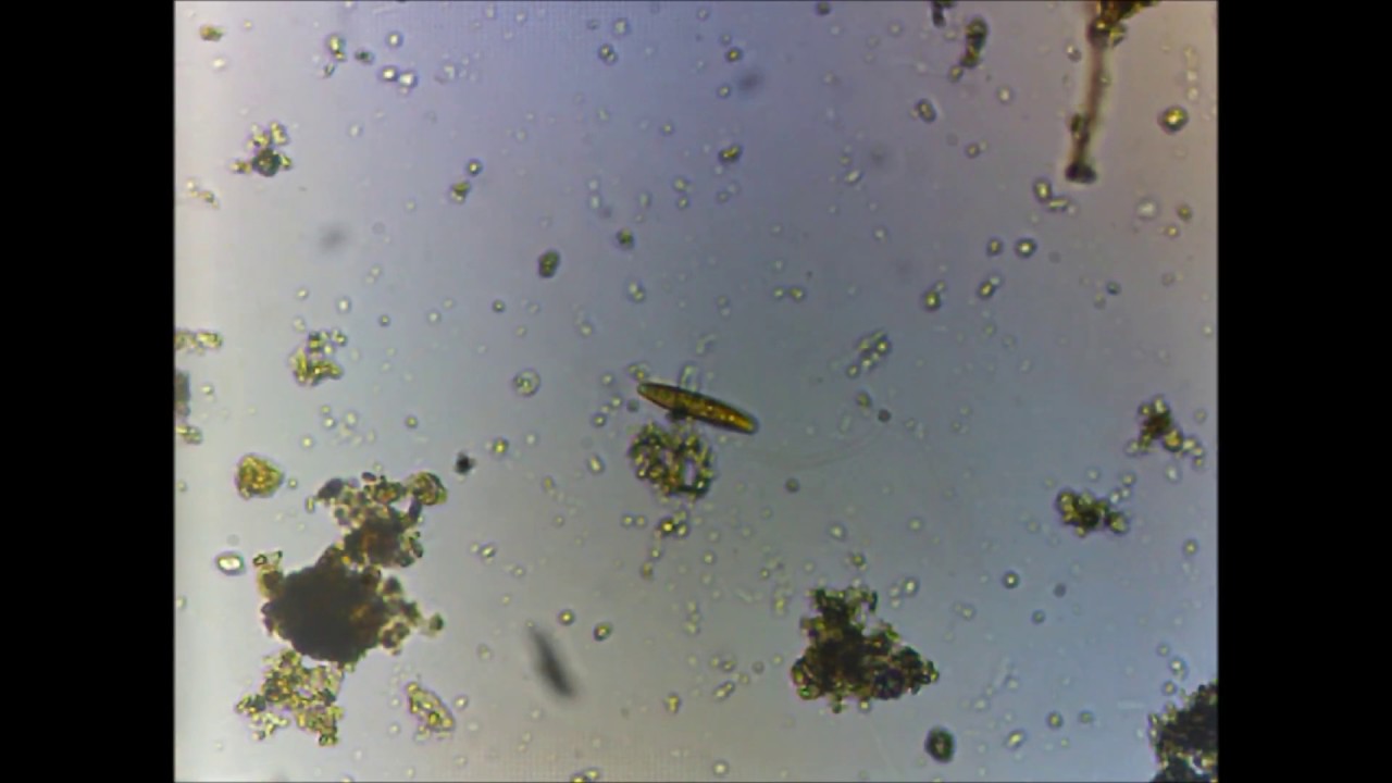 Microorganismos en agua estancada con algas pt. 2 - YouTube