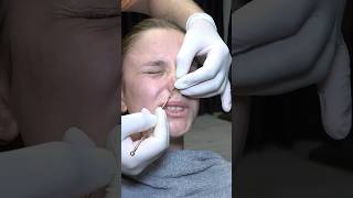 LADY RECEIVED 9 VOLT ELECTROSHOCK MASSAGE AND SKIN CARE #asmr #sleep #skincare #electroshockmassage
