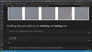 DR VISION | TEAM - BYTE CODERS | SRM 23 | IBM Z DATATHON
