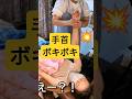 【うぇー!?】手首ボキボキでびっくり！掌が痛い20代女性
