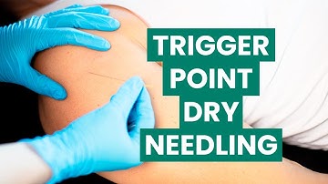 Trigger Point Dry Needling (TDN) | Foothills Sports Medicine Physical Therapy