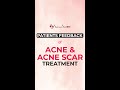 Patient Review - Acne &amp; Acne Scar Treatment at Sakhiya Skin Clinic.