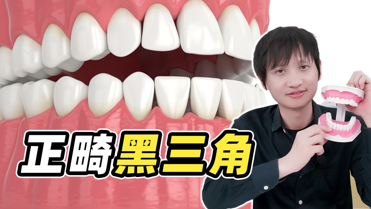 解码黑三角