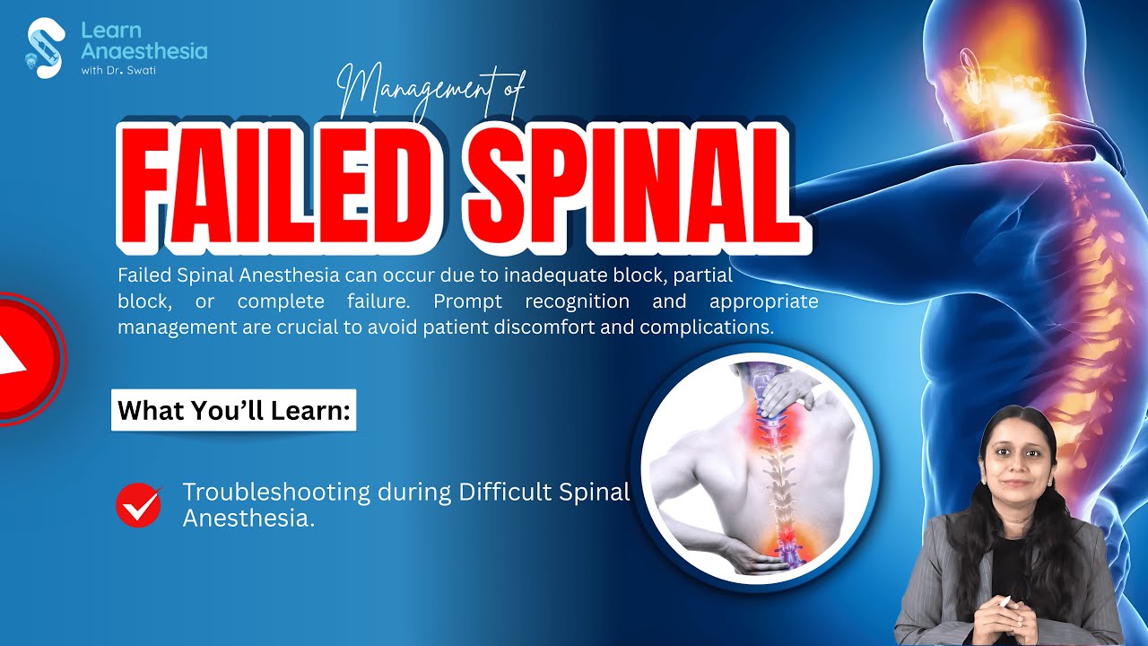 Troubleshooting During Difficult or Failed Spinal Anesthesia | Dr ...