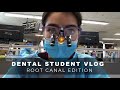 VLOG #2 - Learning Root Canals in Dental School + new loupes, fire drill & live scorpions??