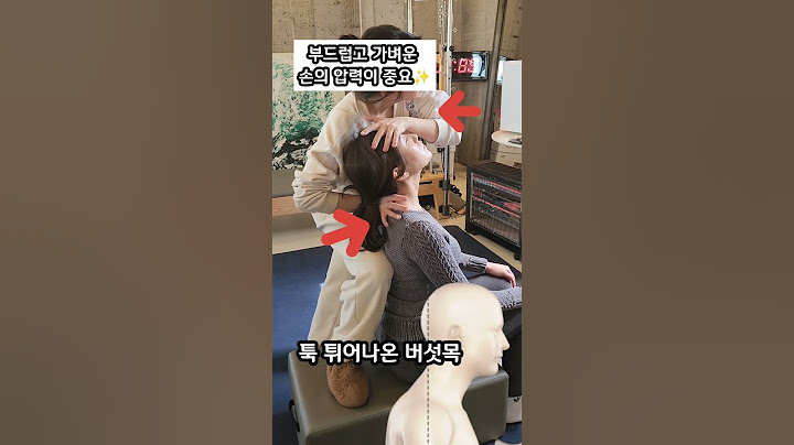 툭 튀어나온 버섯목의 신기한 변화