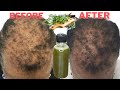 Your hair will grow 5 times faster, dermatologist never reviled these ingredients because it...