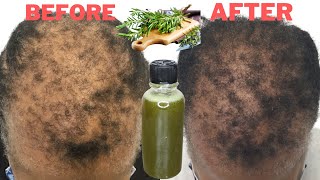 Your hair will grow 5 times faster, dermatologist never reviled these ingredients because it...