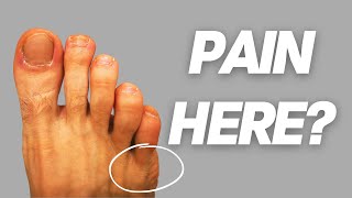 How to Fix a Tailor's Bunion (Bunionette)
