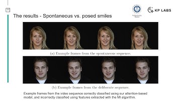 [S+SSPR 2020] Selecting Features from Time Series Using Attention-based Recurrent Neural Networks