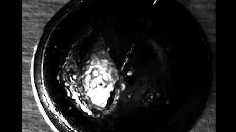 Cavitation bubble collapse and damage