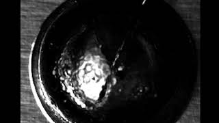 Cavitation bubble collapse and damage