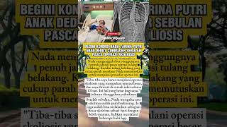 Begini Kondisi Nada Tarina Putri, Anak Deddy Corbuzier Sebulan Pasca Operasi Skoliosis