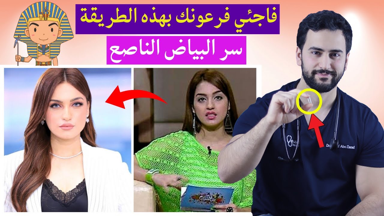 سر الحبة السحرية التي اخفتها عنا ياسمين عز وجعلتها بيضاء كالثلج⁉️