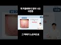 뭘 먹을때마다 땀이 나요 아아를 먹어도 땀이 나요 #식한증 증