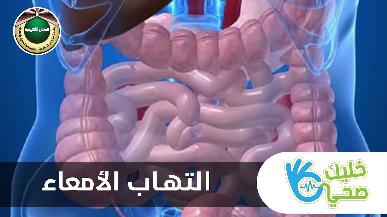 التهاب الأمعاء | خليك صحي 2019
