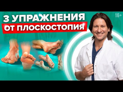 3 самых эффективных упражнения от плоскостопия. Простые советы, как лечить плоскостопие.