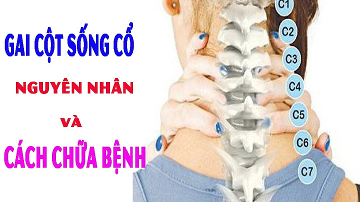 Gai đốt sống cổ là bệnh gì năm 2024