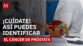 Cáncer De Próstata Tienes Estos Síntomas? Señales Clave Que Debes Saber