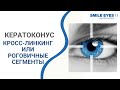 ❓ Кросс-линкинг или роговичные сегменты - какова последовательность лечения при кератоконусе?