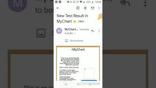 Christus MyChart is giving false notifications of new test results 20200414_125600