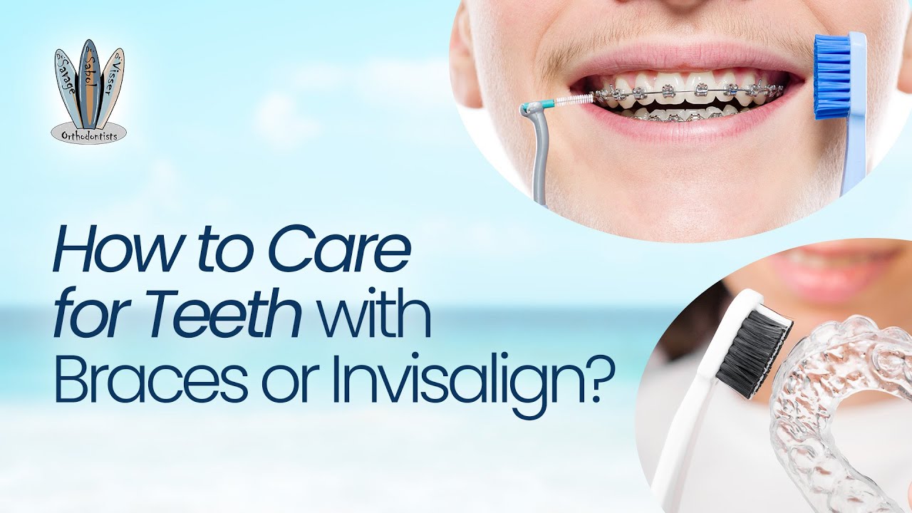 FAQ 8 How To Care For Teeth With Braces Or Invisalign Drs Savage faq-8-how-to-care-for-teeth-with-braces-or-invisalign-drs-savage