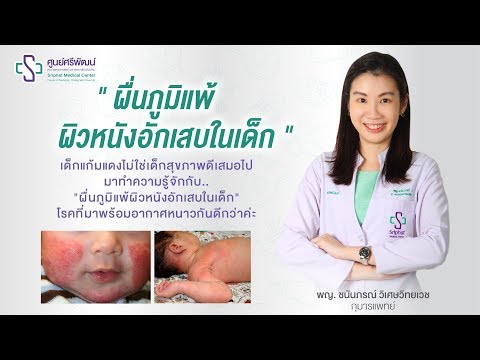 วีดีโอ: วิธีกำจัดโรคผิวหนังภูมิแพ้ในเด็ก