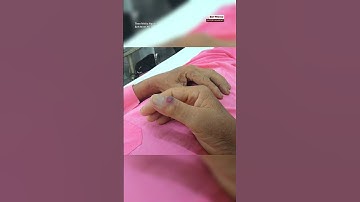 Nhiều người dân bị rắn lục đuôi đỏ tấn công #tinnong #tintuc