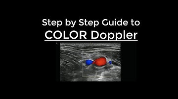 How to use Color Doppler on Ultrasound - Step by Step Guide