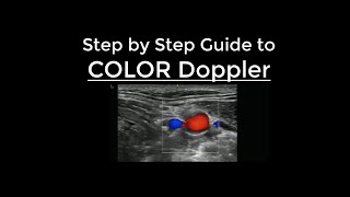 How to use Color Doppler on Ultrasound - Step by Step Guide screenshot 1