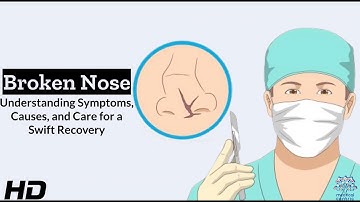 Broken Nose  Understanding Symptoms, Causes, and Cures 1080p 231026
