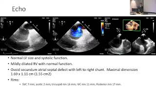 Interesting Cases in Adult Congenital Heart Disease and Structural Interventions