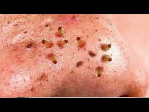 Video toi va em - youtube