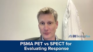 Using PSMA PET or SPECT to Evaluate Response to Treatment