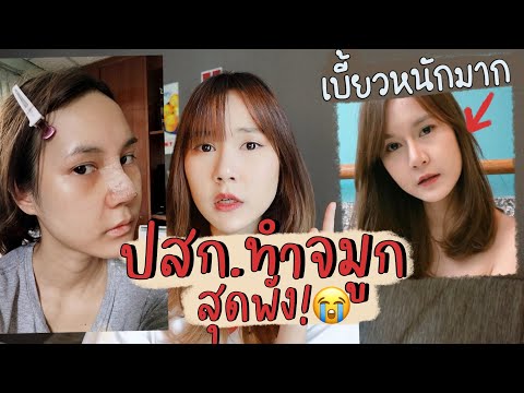 แชร์ประสบการณ์ทำจมูกสุดพัง รีวิวเอาซิลิโคนจมูกออก! | This is Pear