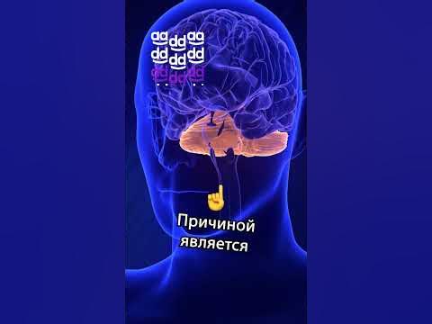 😱 СИНДРОМ ЧУЖОЙ РУКИ 👽 #facts #shorts - YouTube