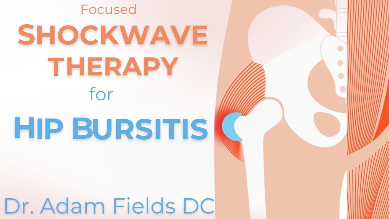 Shockwave Therapy for Hip Bursitis | ESWT | Greater Trochanteric Pain Syndrome (GTPS)