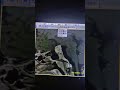 Mri brain pituitary Sella dilated #1000subscriber