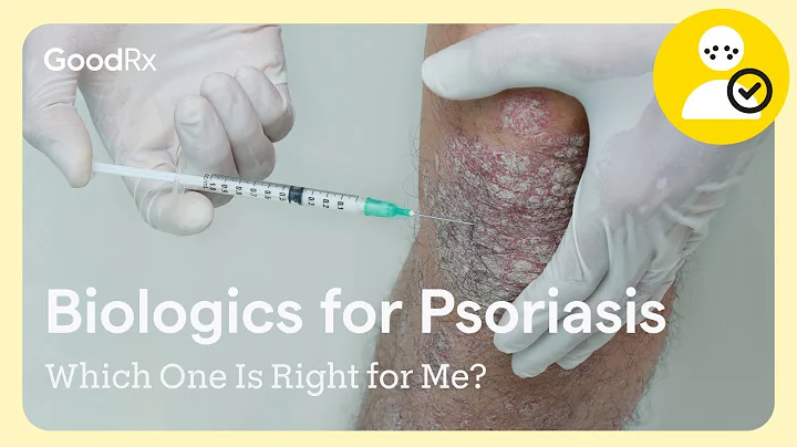 Choosing a Biologic for Psoriasis: Which One Is Right for Me? | GoodRx