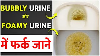 shorts Bubbly Urine और Foamy Urine में फर्क जाने | Normal Urine vs Foamy Urine | Foamy Urine Causes