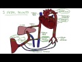 Understanding Fetal Circulation