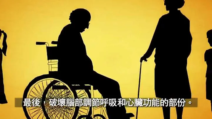 认识阿兹海默症(失智症、老人痴呆症) - 天天要闻