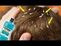 Get Rid of Head Lice With Only One Ingredient